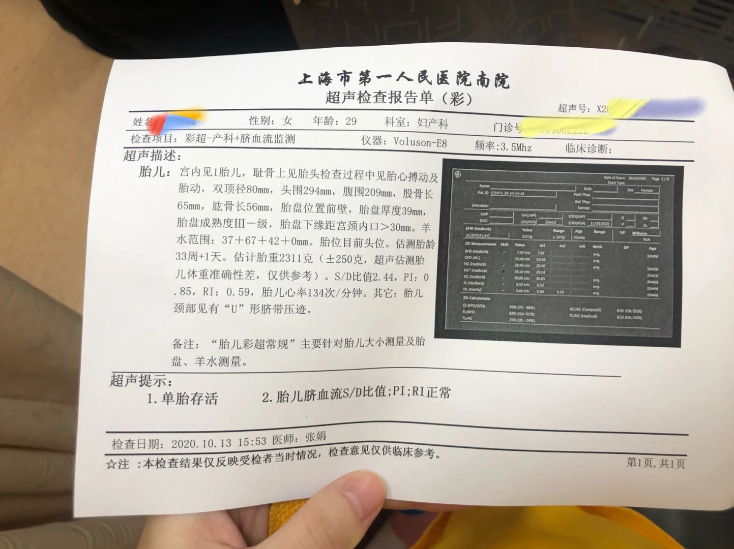 34周b超单,试管代孕选性别