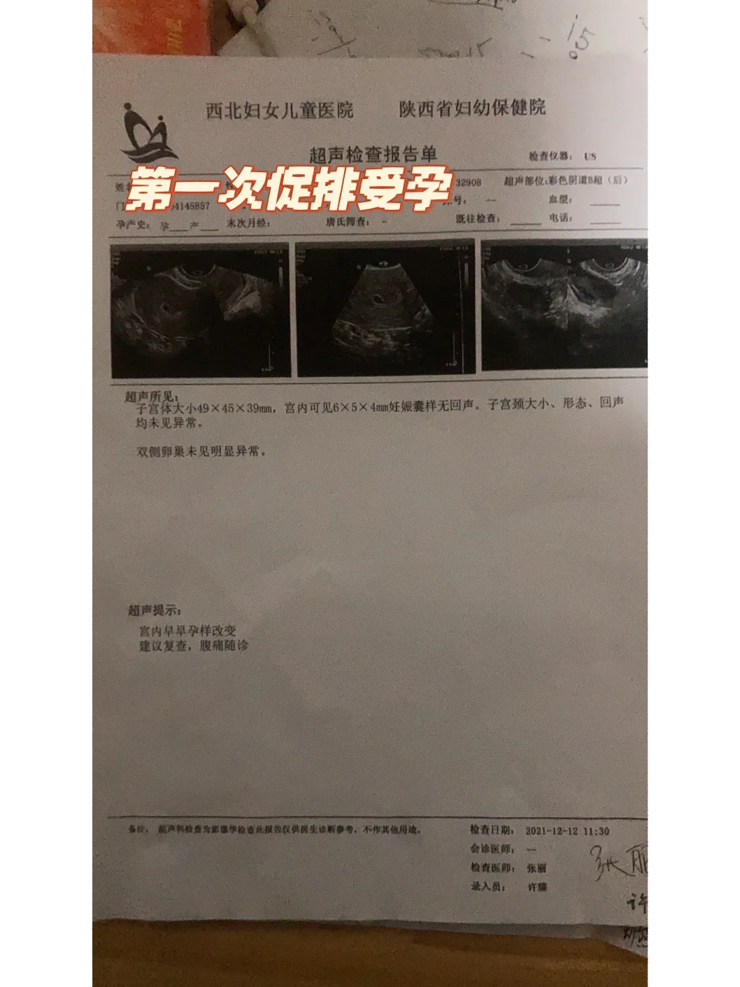多囊 促排 胎停 经历才懂29岁终于迎来她了,试管代孕多少钱